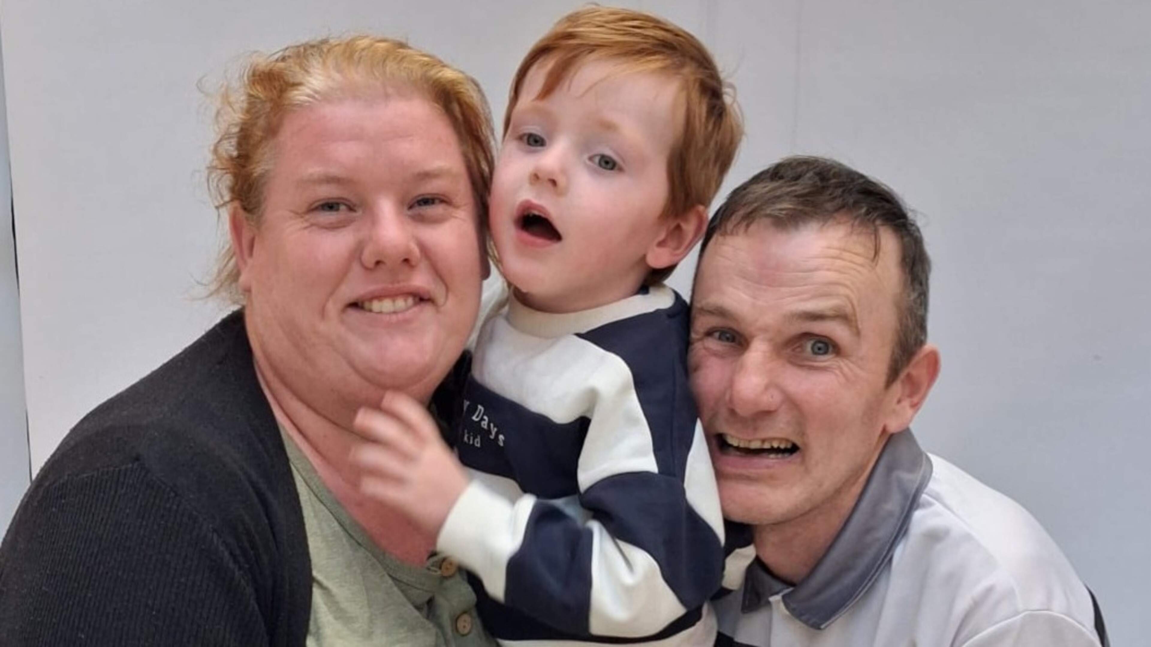 ‘One fall from a bike without a helmet changed my life forever’